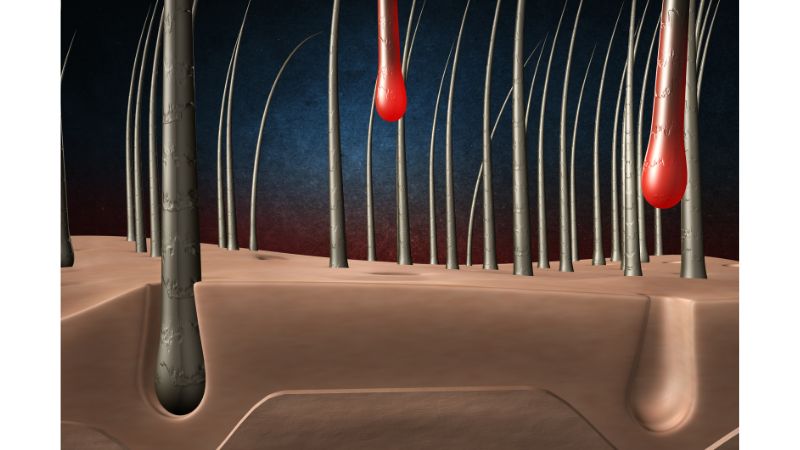 أسباب تساقط الشعر عند النساء